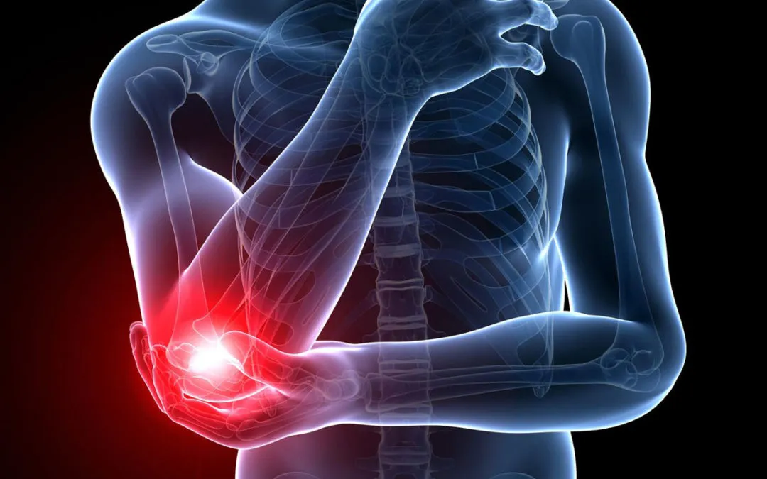 What Are The 5 Most Common Elbow Injuries 7109
